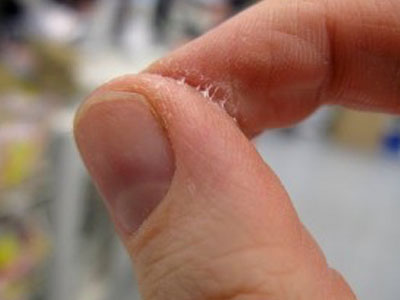 Como remover a cola dos dedos