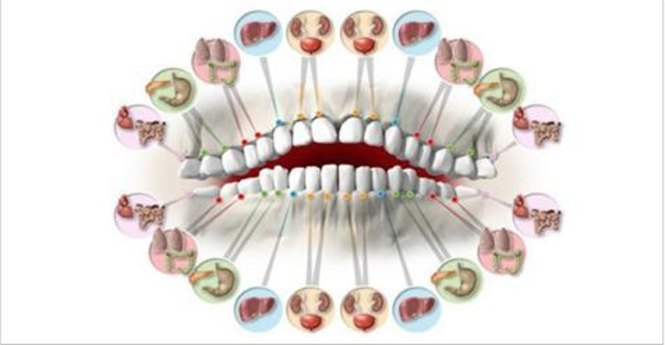 Saiba a que órgão está relacionado cada dor de dente!